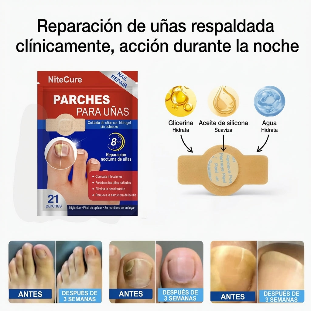 NiteCure™ Recuperación nocturna para hongos en las uñas