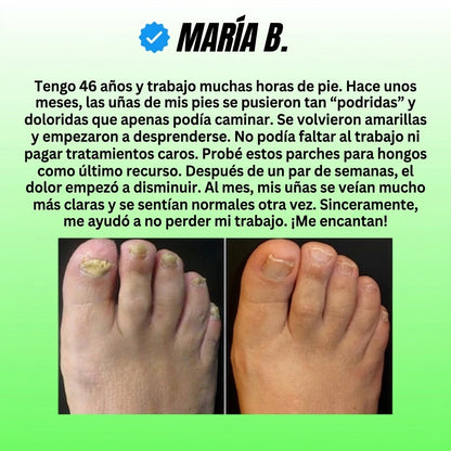 NiteCure™ Recuperación nocturna para hongos en las uñas